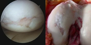 the image of the surface of the knee joint